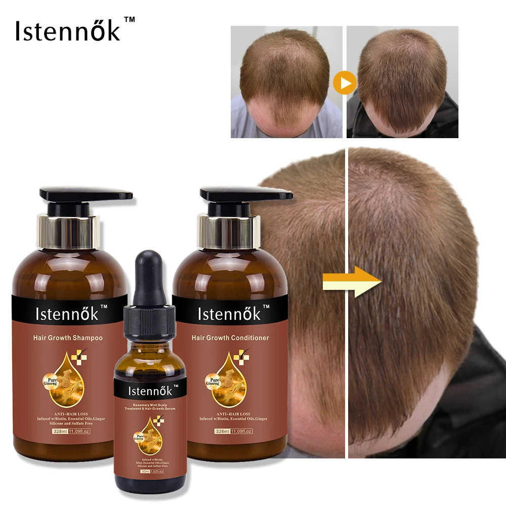 2023 Professional Hair Growth Products Shampoo And Conditioner Serum For Women Men Ginger Hair Regrowth Set Anti Hair Loss