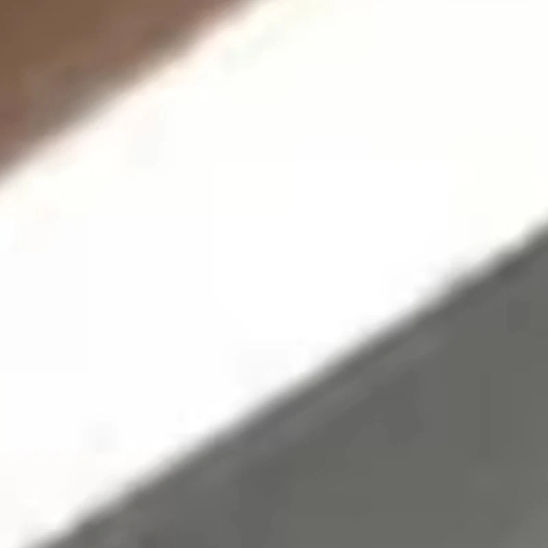 

5Pcs Dental Filling Kit Autoclavable Silicone Handle Spatula for Aesthetic Restoration Dentist Clinic Lab Equipment