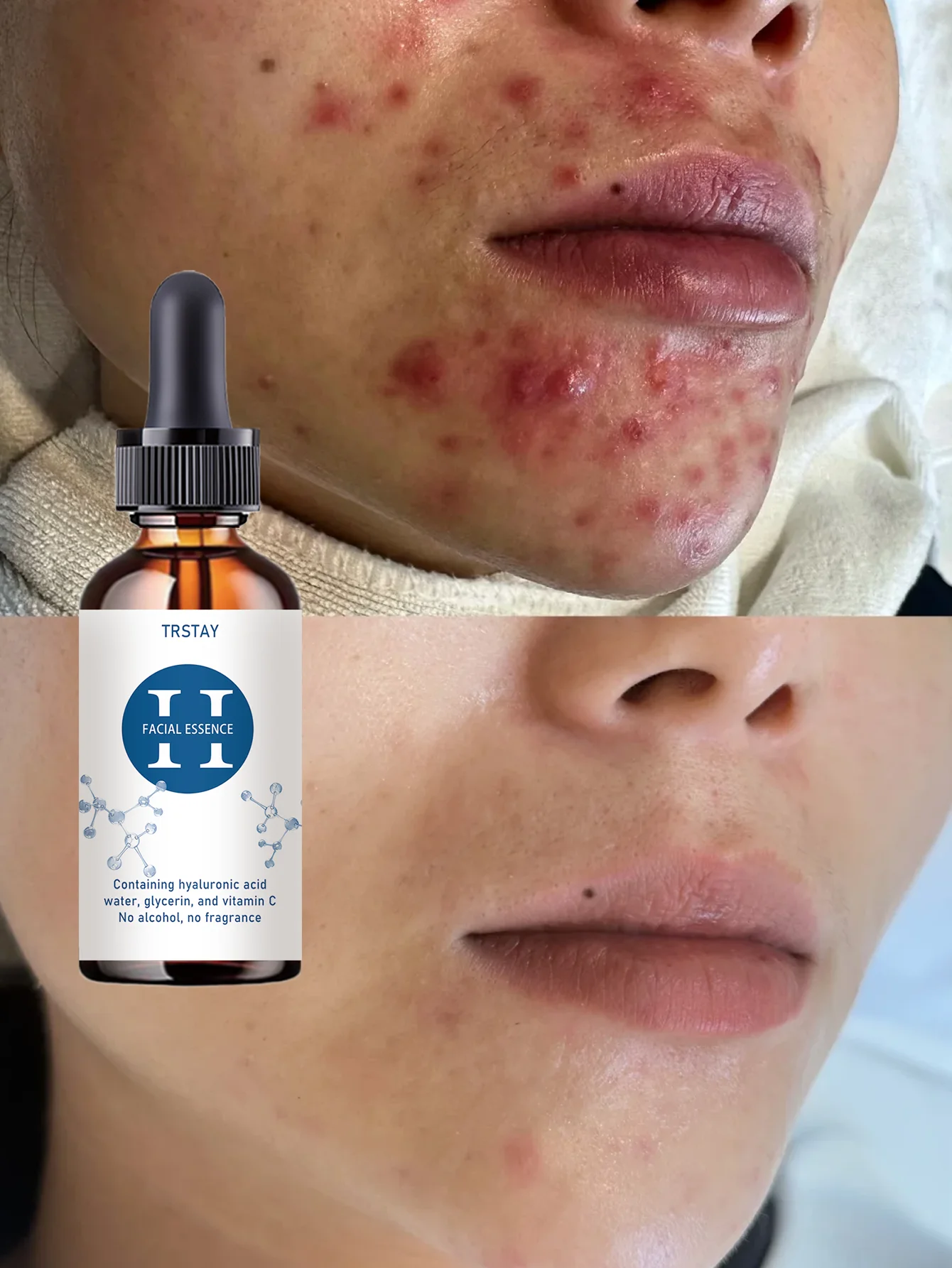 Moisturizing Natural Fragrance Scented Facial Oil for Relaxing Skin Treatment Tightening Serum to Enhance Skin Elasticity Radian - Image 4