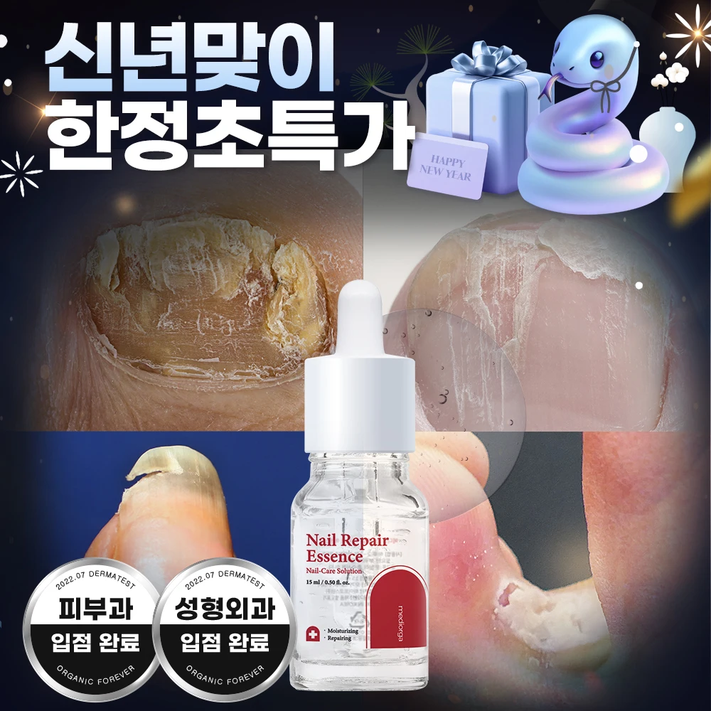 [Special Limited Sale Offer] Mediorga Nail Repair Essence: Intensive Care Serum for Fungal Infections and Nail Issues