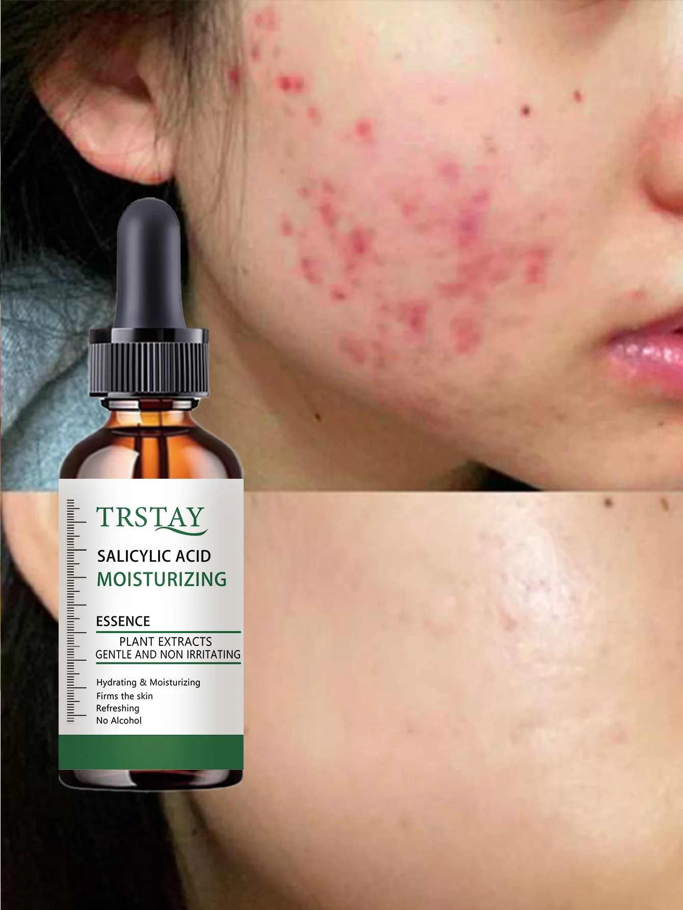 Hydrating Serum to Fight Skin Sagging Deeply Moisturize and Plump Skin for Youthful Glow Long Lasting Hydration for a Firmer Com