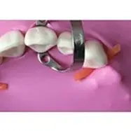 

Dental Rubber Dam Stabilizing Cord Elastic Wedges Clamps Sheets Rubber Barrier Wedge Line 2.1M /dia 1.8Mm