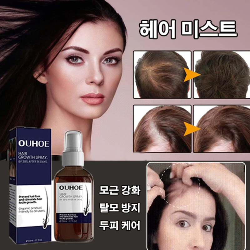 Hair growth essence female hair loss nutrient scalp hair loss Mist female hair loss nutrient hair growth essential oil hair growth Serum against hair loss/scalp