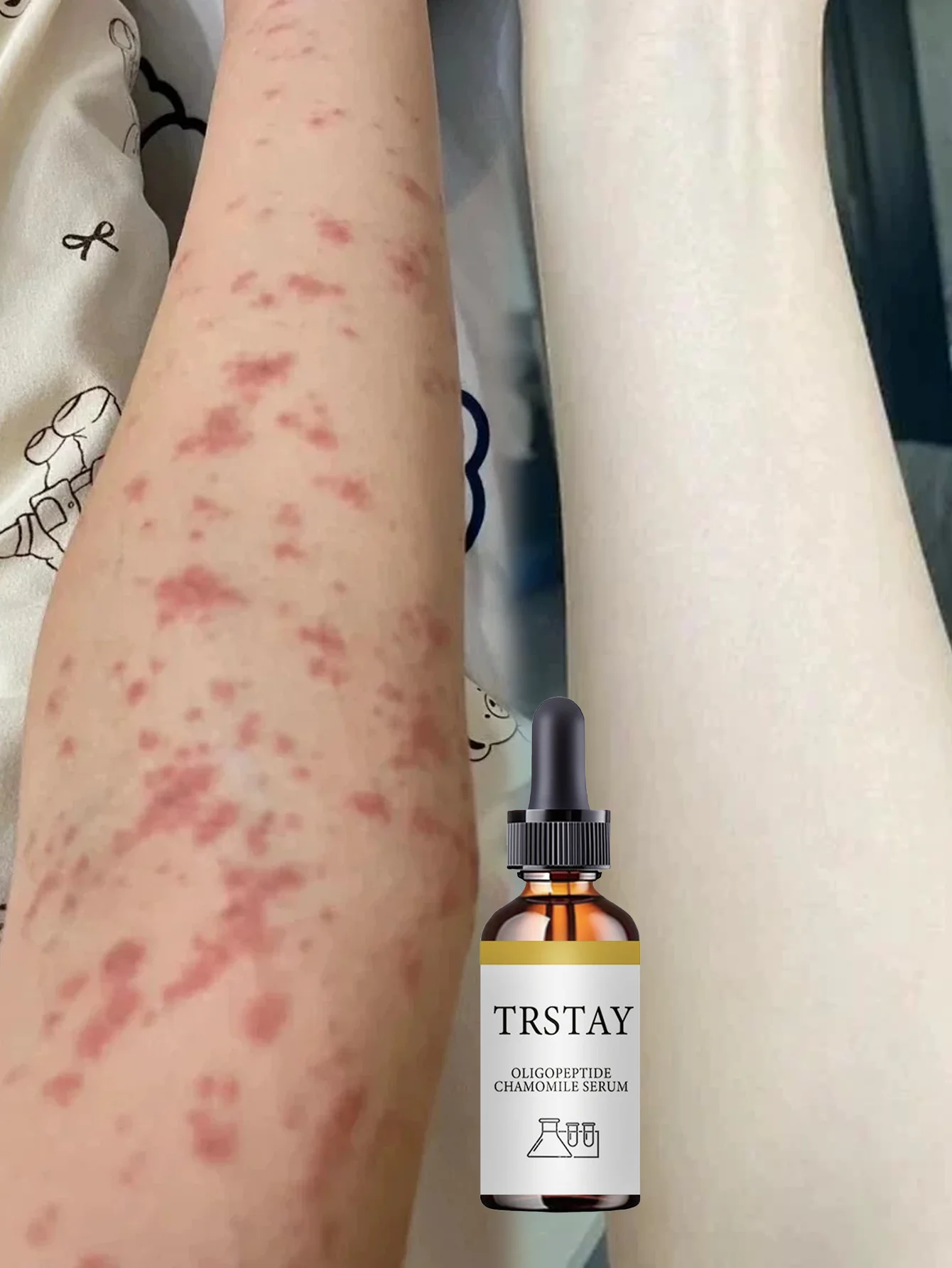 Moisturizing Vitamin E Hydrating Light Body Oil Essential Oil Improves Dullness Moisturizes Dry Skin Nourishing Formula for Skin - Image 5