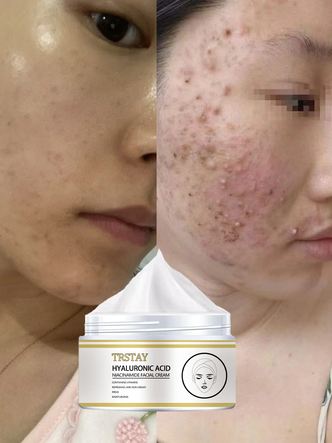 

72H Увлажняющее масло для лица для сухой кожи Нежирная увлажняющая сыворотка Глубоко питательное средство для ухода за лицом Эфирное масло для сияющих лыж