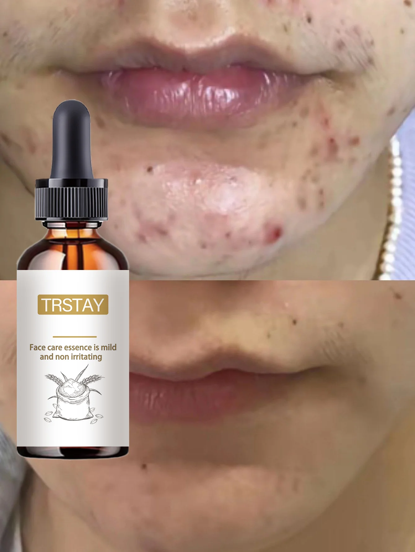 Moisturizing Spot Lightening And Skin Brightening Essence With Hydrating Formula To Even Skin Tone And Enhance Glow For Radiant - Image 6