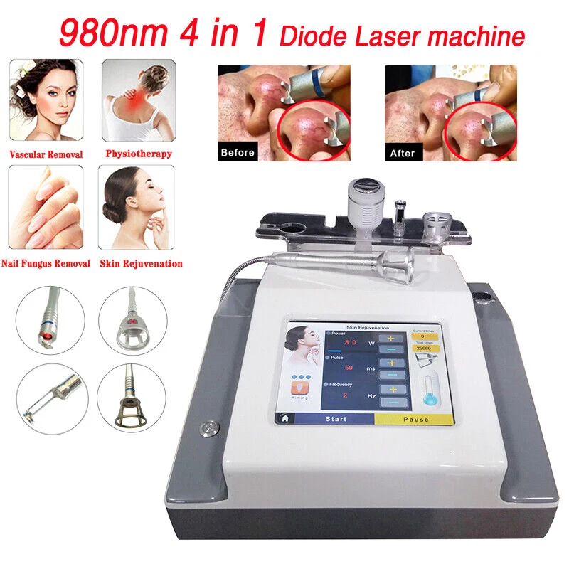 4 in 1 980nm Diode Laser Spider Vein Removal Vascular Treatment Remove onychomycosis Pain Relief with Cold Hammer