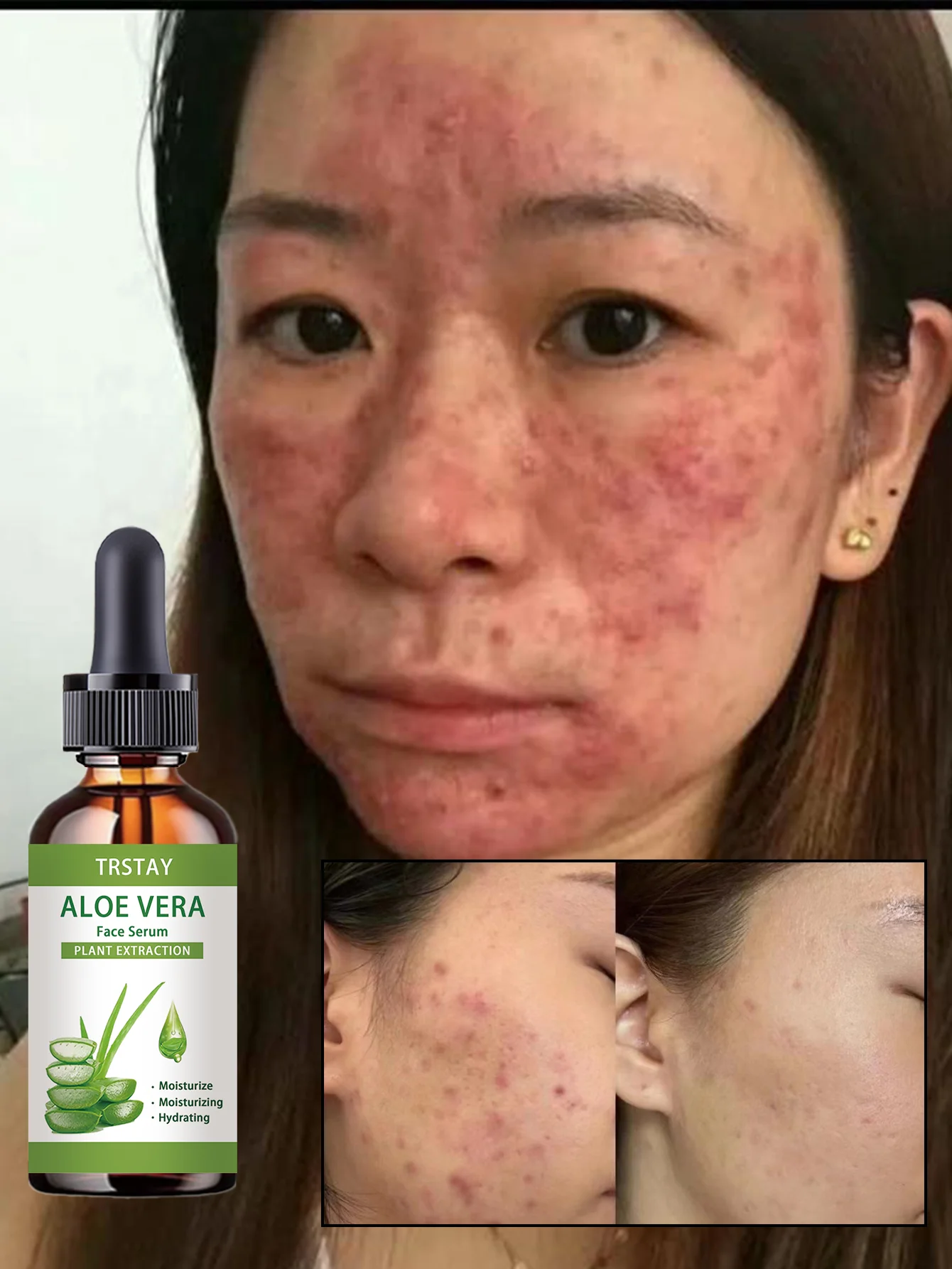 Hydrating Spot Lightening Anti Wrinkle Essence with Intelligent Moisturizing Technology for Sculpting Delicate Skin and Soothing - Image 5