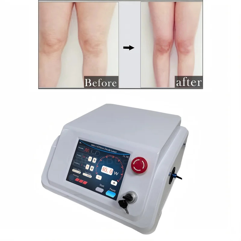 

Newest 980 1470nm Diode Laser Machine Face lift Anti Inflammatory Facial Machine Anti Celluite 5 Types Single-Dual-Band Device