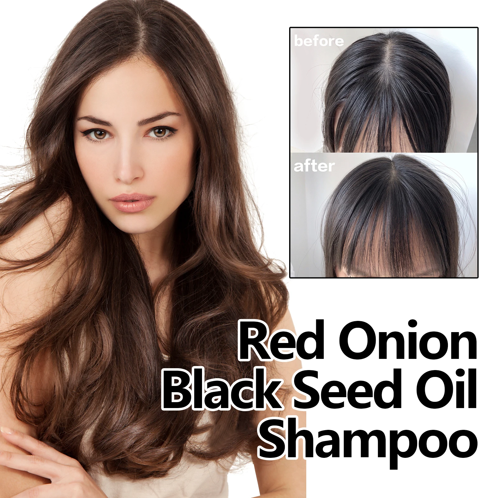 Eelhoe Red Onion Black Seed Oil Shampoo Refreshing Anti-dandruff Clean Nourish Scalp Smooth No Split Oil Control Shampoo