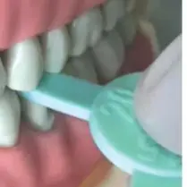 

4Pcs/kit Dental Diastema Measuring Ruler Tooth Wedge Diastema Measuring Tool Dentistry Consumables