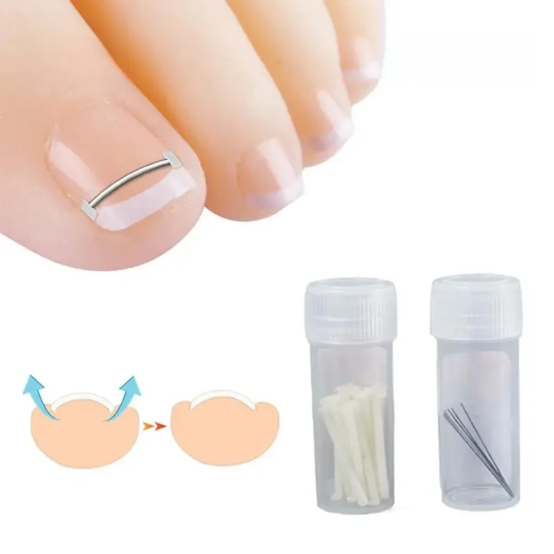 Outils de pédicure professionnels, traitement des ongles incarnés, gélatine de récupération, soins des pieds