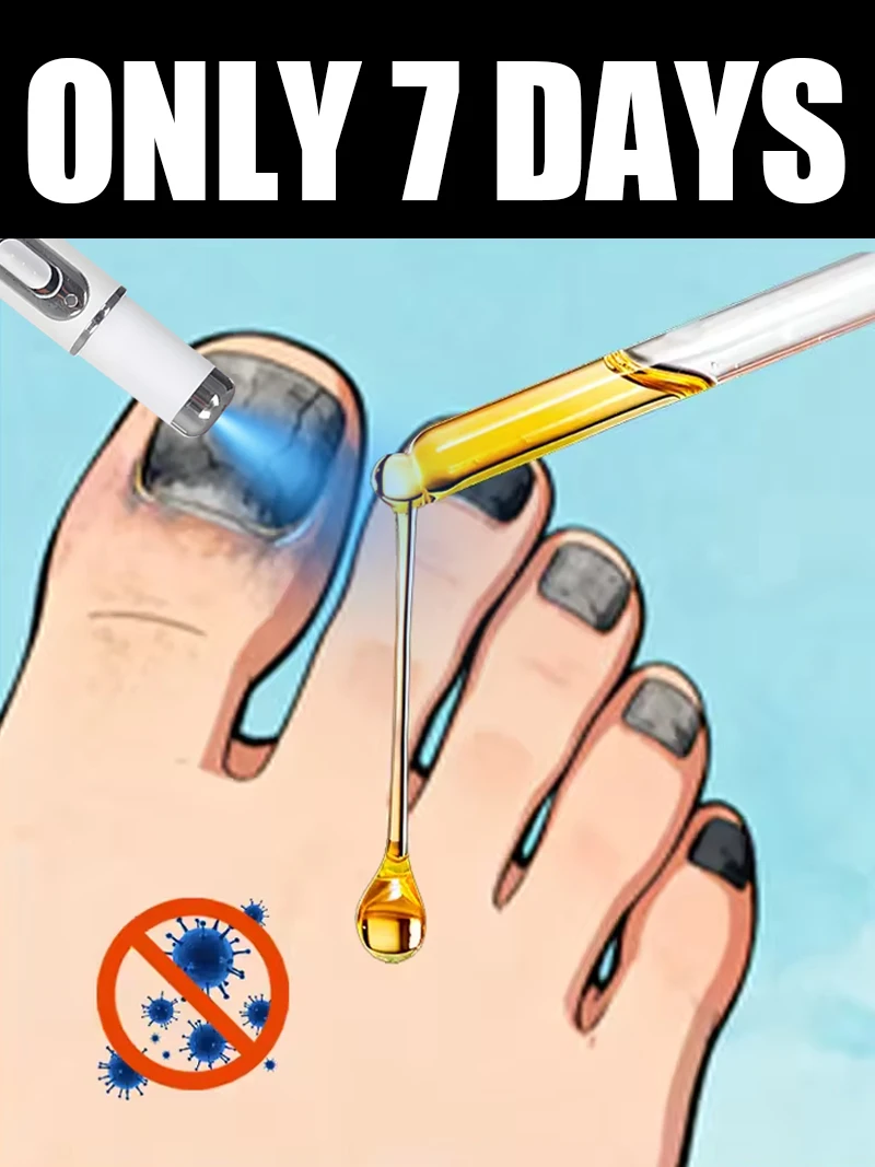 

Generation-2 Laser Says Goodbye To Bad Manicure In 7 Days