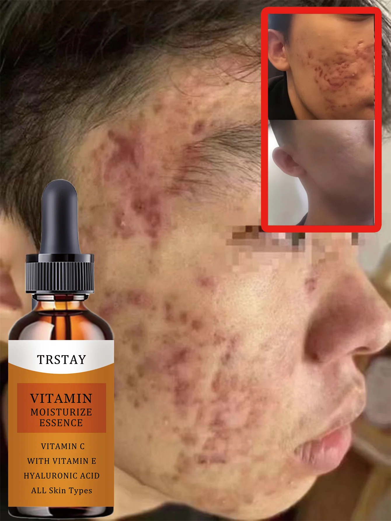 Hydrating Lightweight Nourishing Oil for Dehydrated Skin Deep Moisture Repair Serum with Natural Ingredients for Dry Sensitive S - Image 6