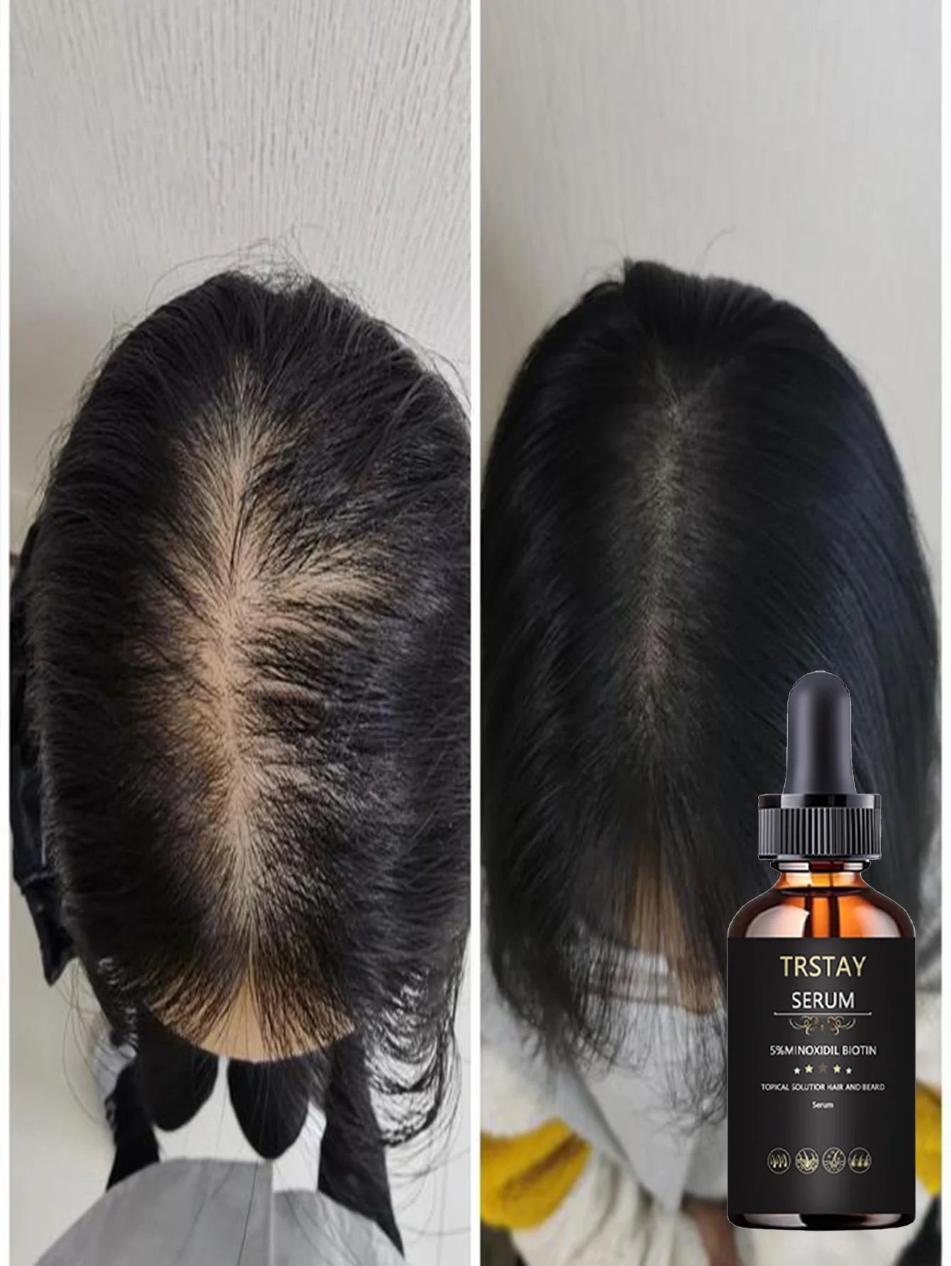 زيت عطري مرطب يعزز الشعر ويحسن مرونة الشعر وترطيب الشعر الناعم ويبدو أكثر سمكًا، محلول العناية بالشعر الطبيعي