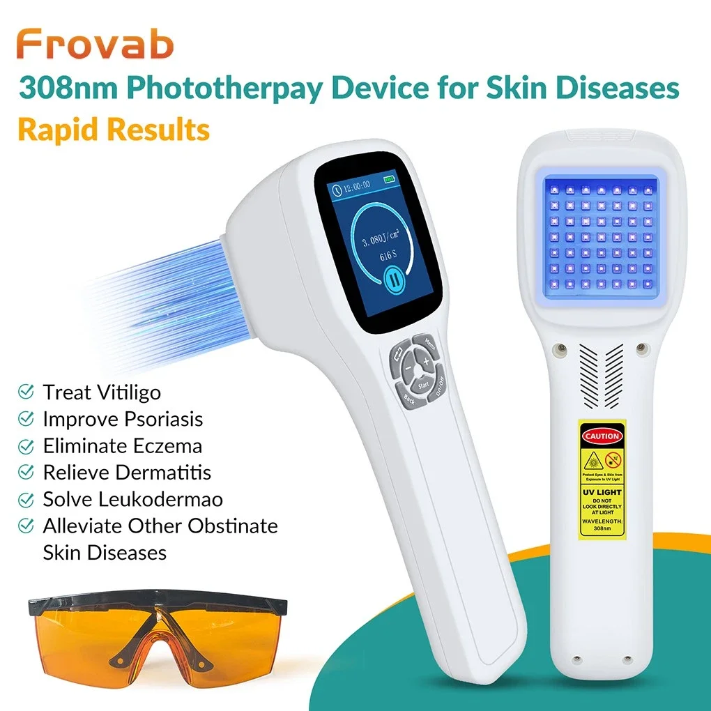 Frovab 308nm UVB Phototherapy Machine Professional Medical Narrowband Lamp for Vitiligo Psoriasis Eczema Treatment Handheld