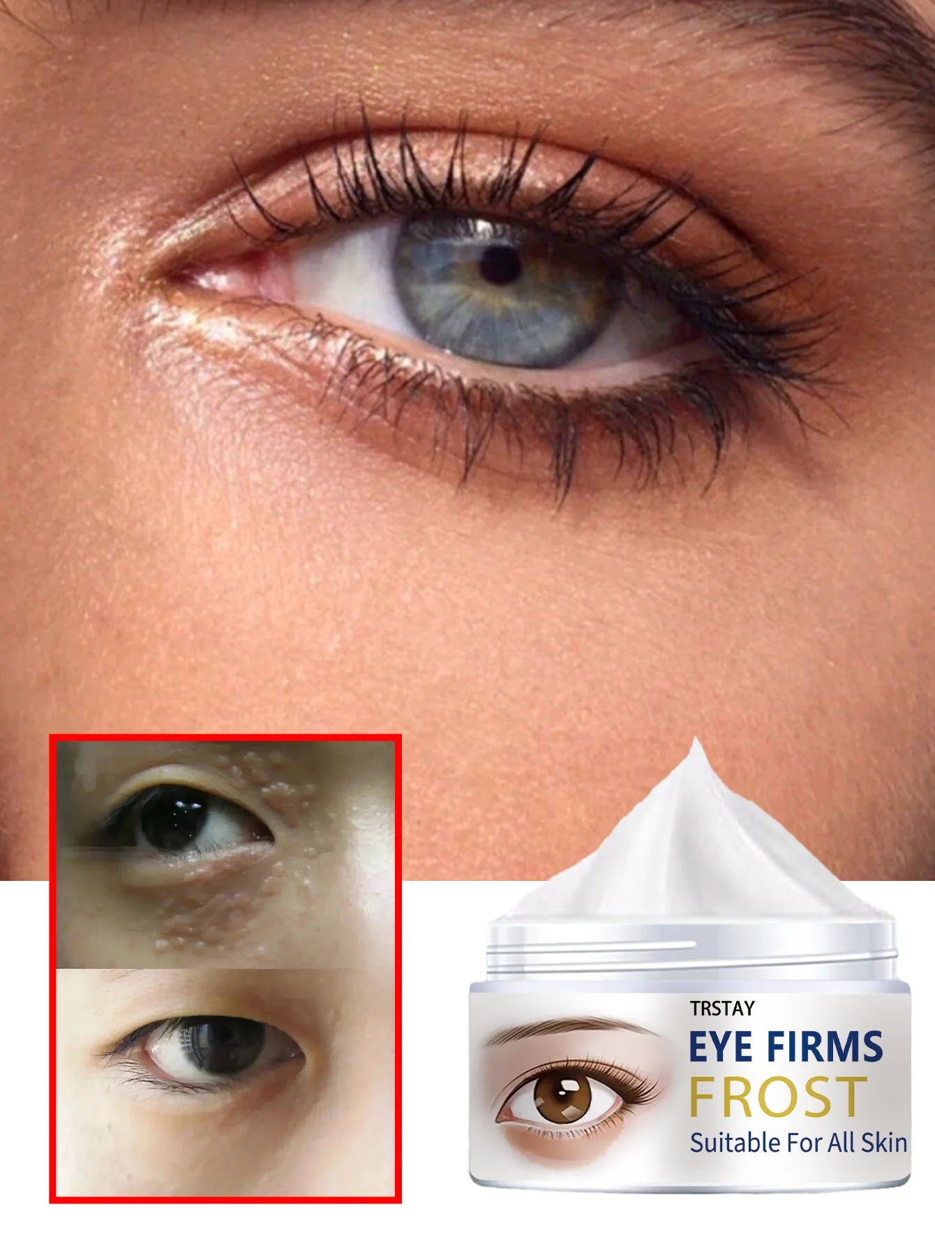 

Питательный крем для глаз от темных кругов и отечности Fade Away Vanish Легко проникает, отпугивает тьмяность, осветляет глаза