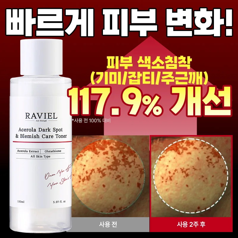 라비엘 아세로라 잡티 & 기미 케어 토너 150ml / 3일 기미 개선 임상완료 기미케어 잡티 화이트닝 보습