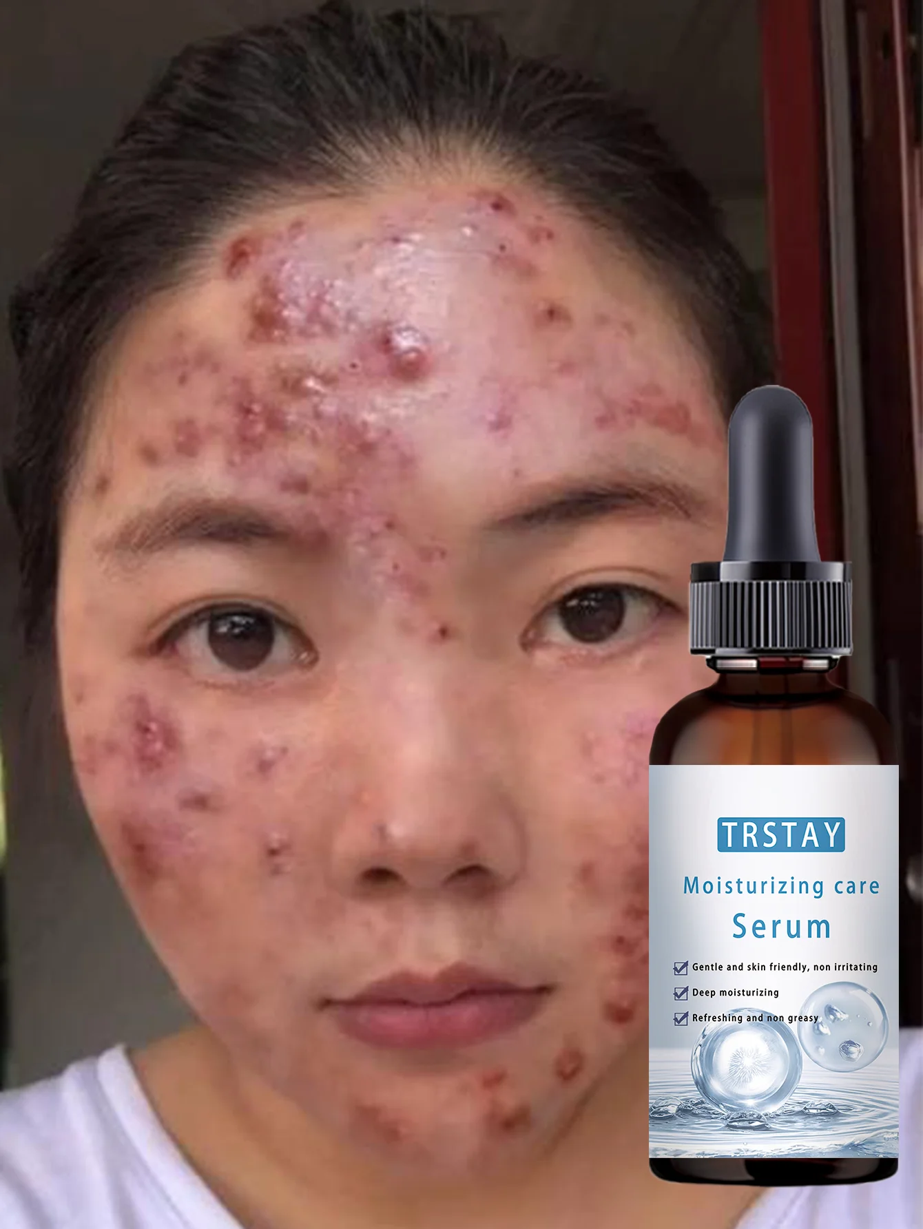 All Skin Types Brightening Serum Hydrates and Fights Acne Boosts Skin Elasticity Reduces Dryness and Looseness for Youthful Glow - Image 5