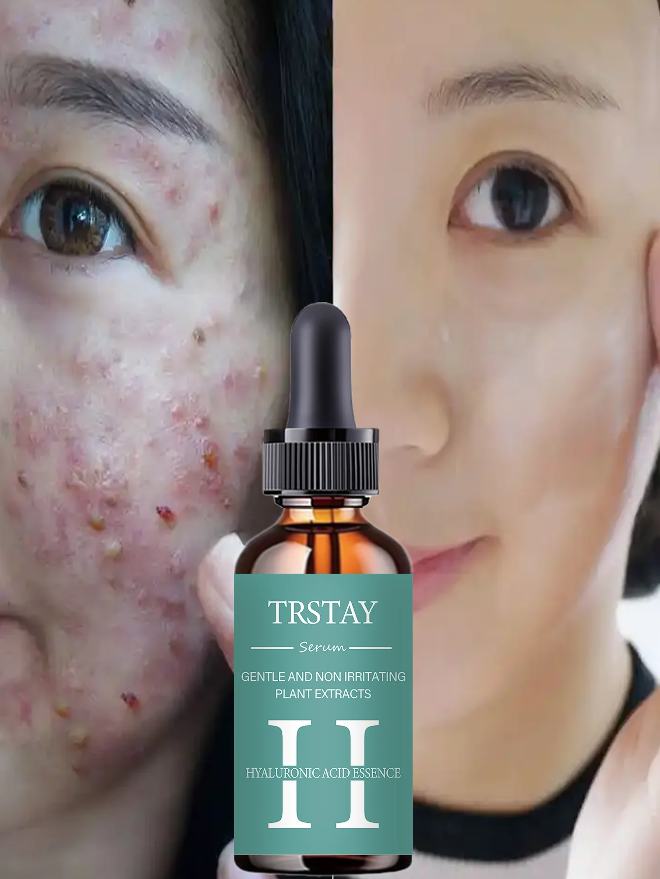 Hydrating Facial Oil Travel-Size On-the-Go Moisture Boost for Dry Skin Nourishing and Revitalizing Serum with Natural Ingredient