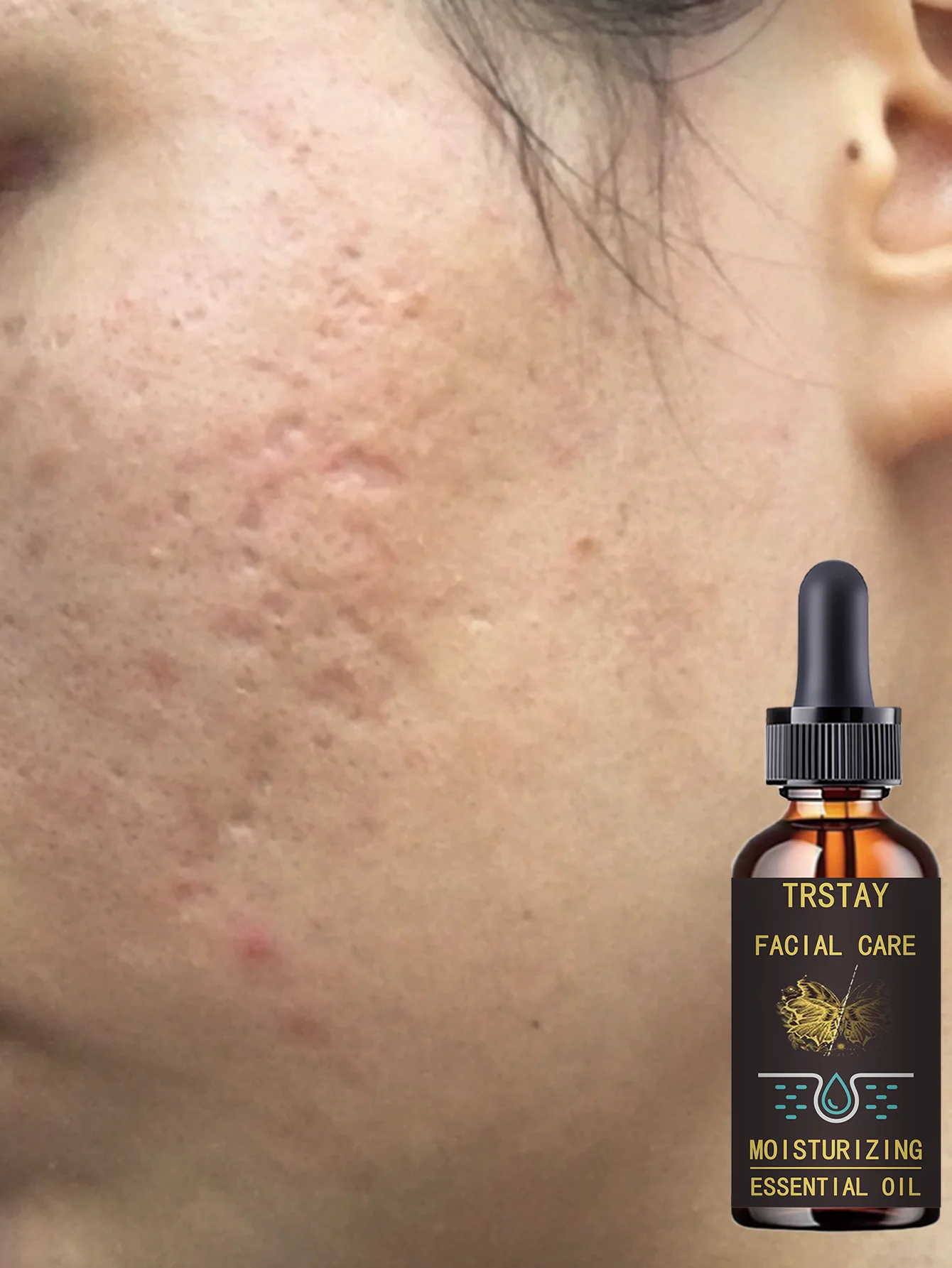 Deeply Moist Anti Wrinkle Essence Milk for Tender Skin with Whitening Benefits Hydration Treatment to Improve Skin Texture and P - Image 4