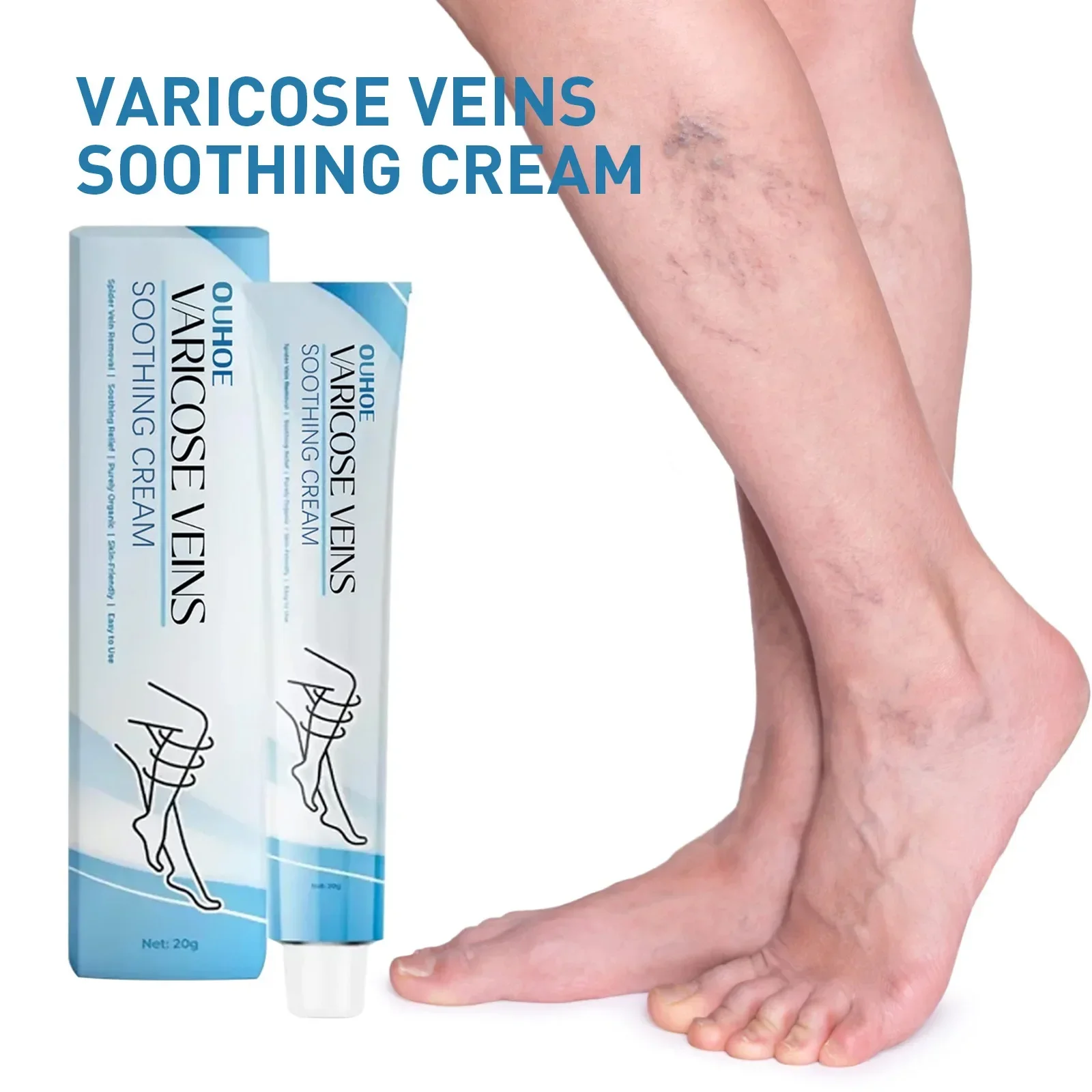 Relieve Vasculitis Cream Phlebitis Worm Spider Legs Vessel Pain Treatment Soothing Reduce Swelling Varicose Vein Relief Ointment