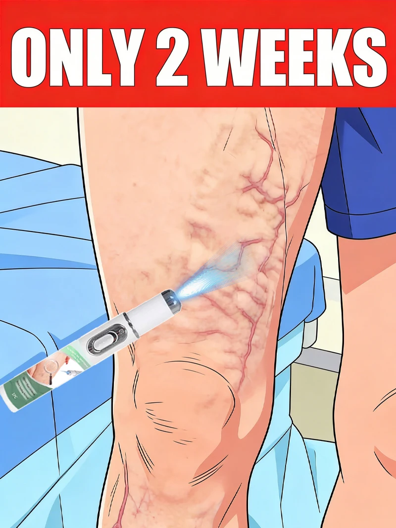 

Новая ручка-аппликатор с синим светом 2026 года для лечения венозной недостаточности: инструмент для ухода за ногами