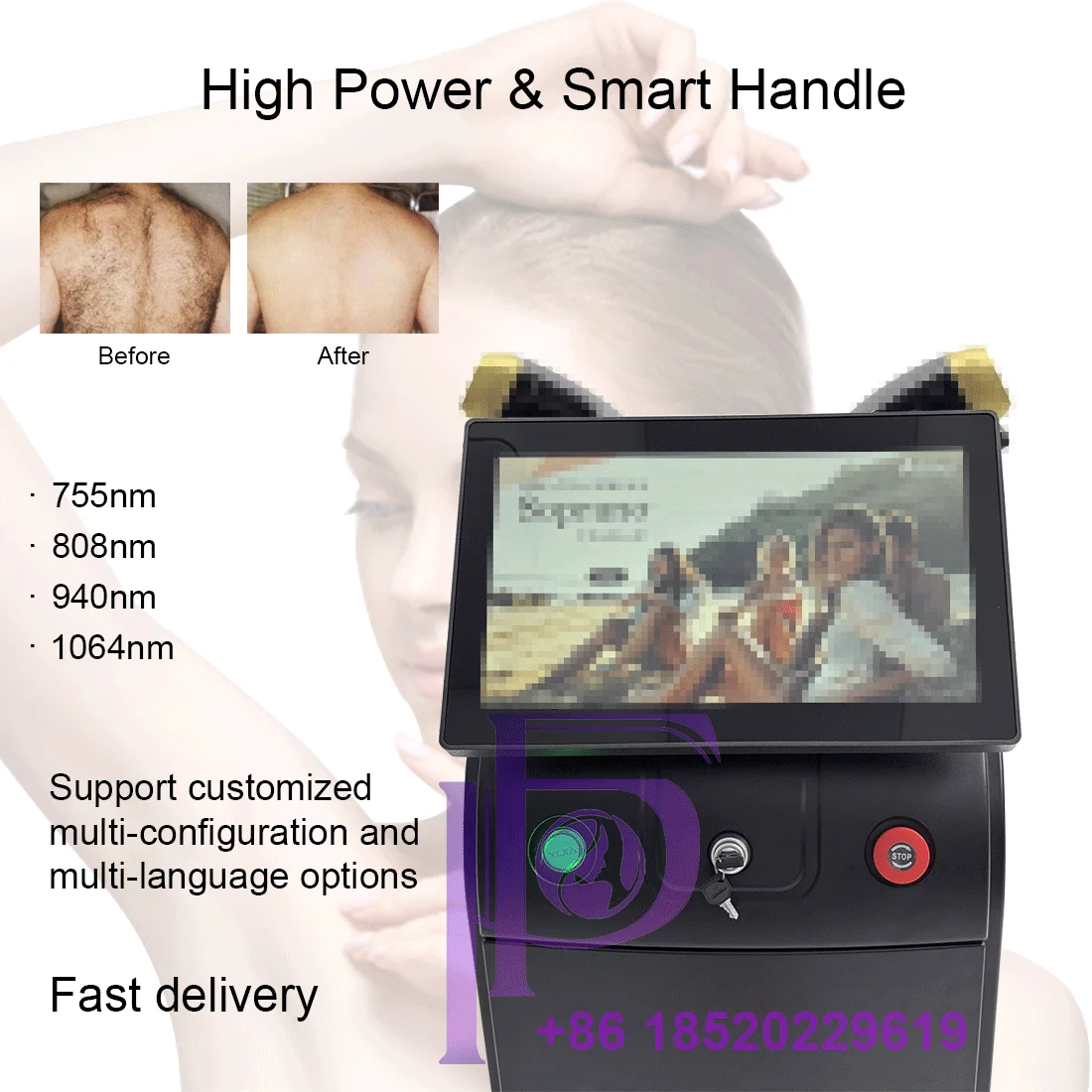 

Diode Laser Hair Removal Machine, Painless Cooling, 4 Wavelengths (755/808/940/1064nm) for Clinic & Home