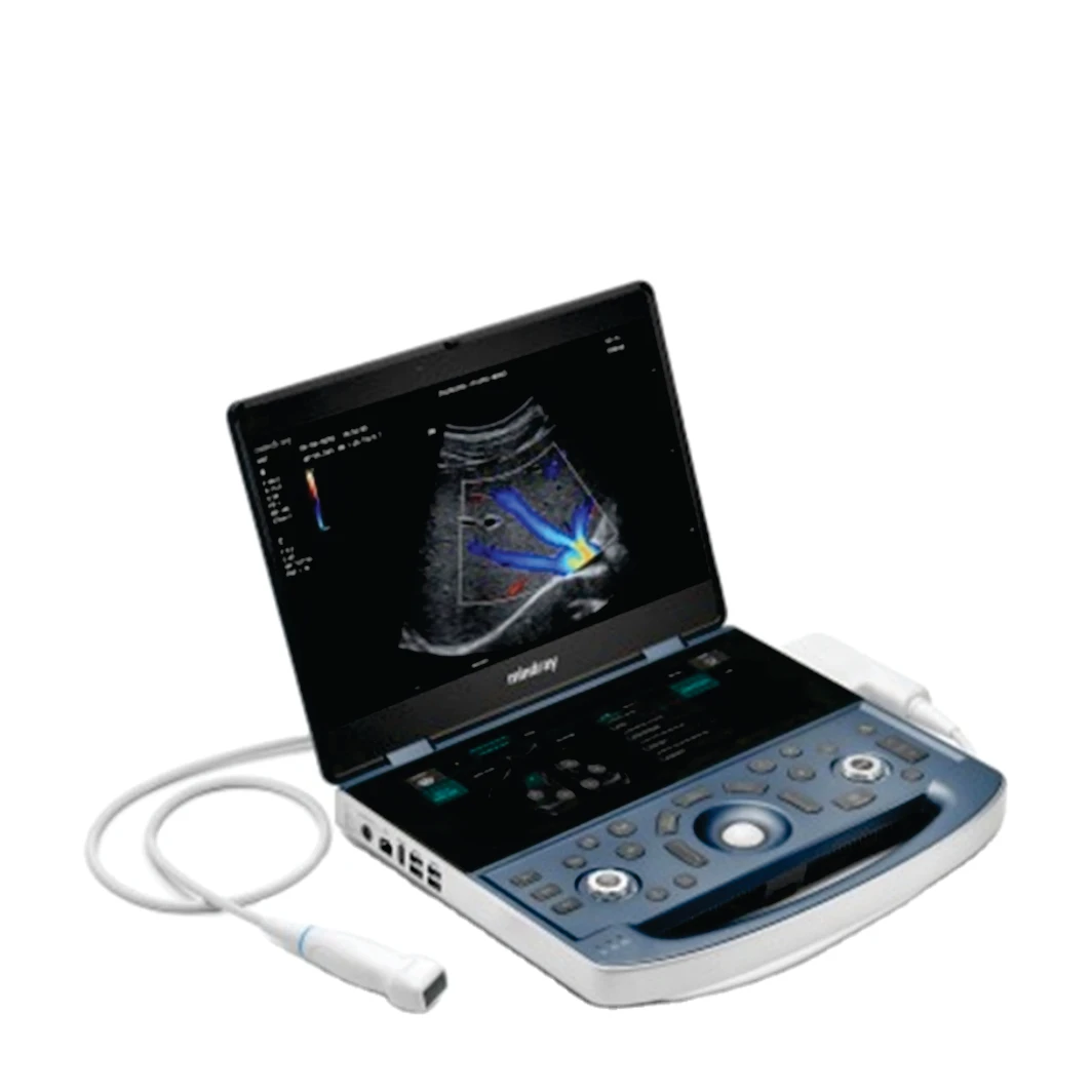 

SH | Buy 2 Get 1 Free - Mindray MX7 Human Portable Color Doppler Ultrasound Machine Portable Echo Machine