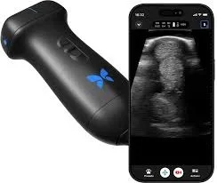 Kaufen Sie 5, Erhalten Sie 3 Gratis Iq3 BUTTERFLY PORTABLE ULTRASOUND