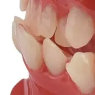 

Модель зубов, обучающее исследование, демонстрационный инструмент, модель, стандартная модель студента-стоматолога для обучения 3D