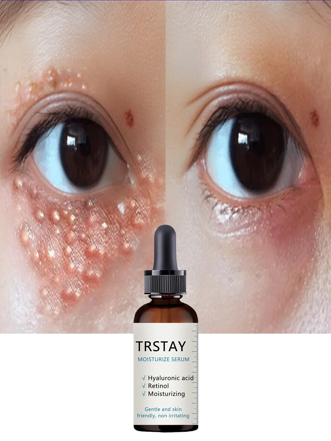 Eye Brightening Moisturizing Oil for Dark Circles All Skin Types Hydrating Under Eye Treatment with Natural Ingredients to Reduc - Image 3