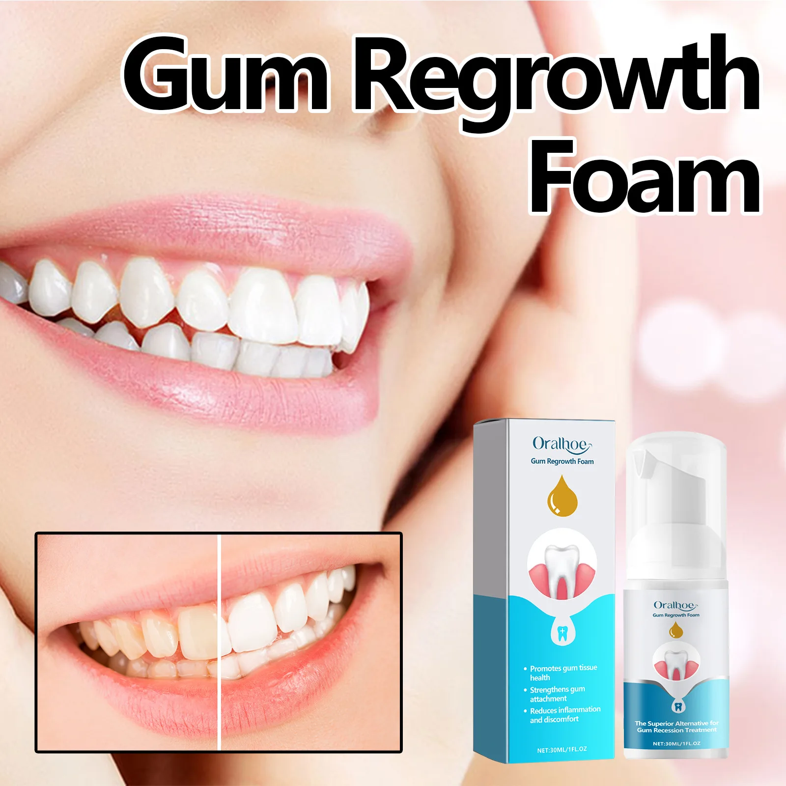 Oralhoe 30ml Gum Regrowth Foam Mousse Toothpaste Teeth Whitening Remove Yellow Stain Cleaning Bad Breath Fresh Gum Repair Mousse