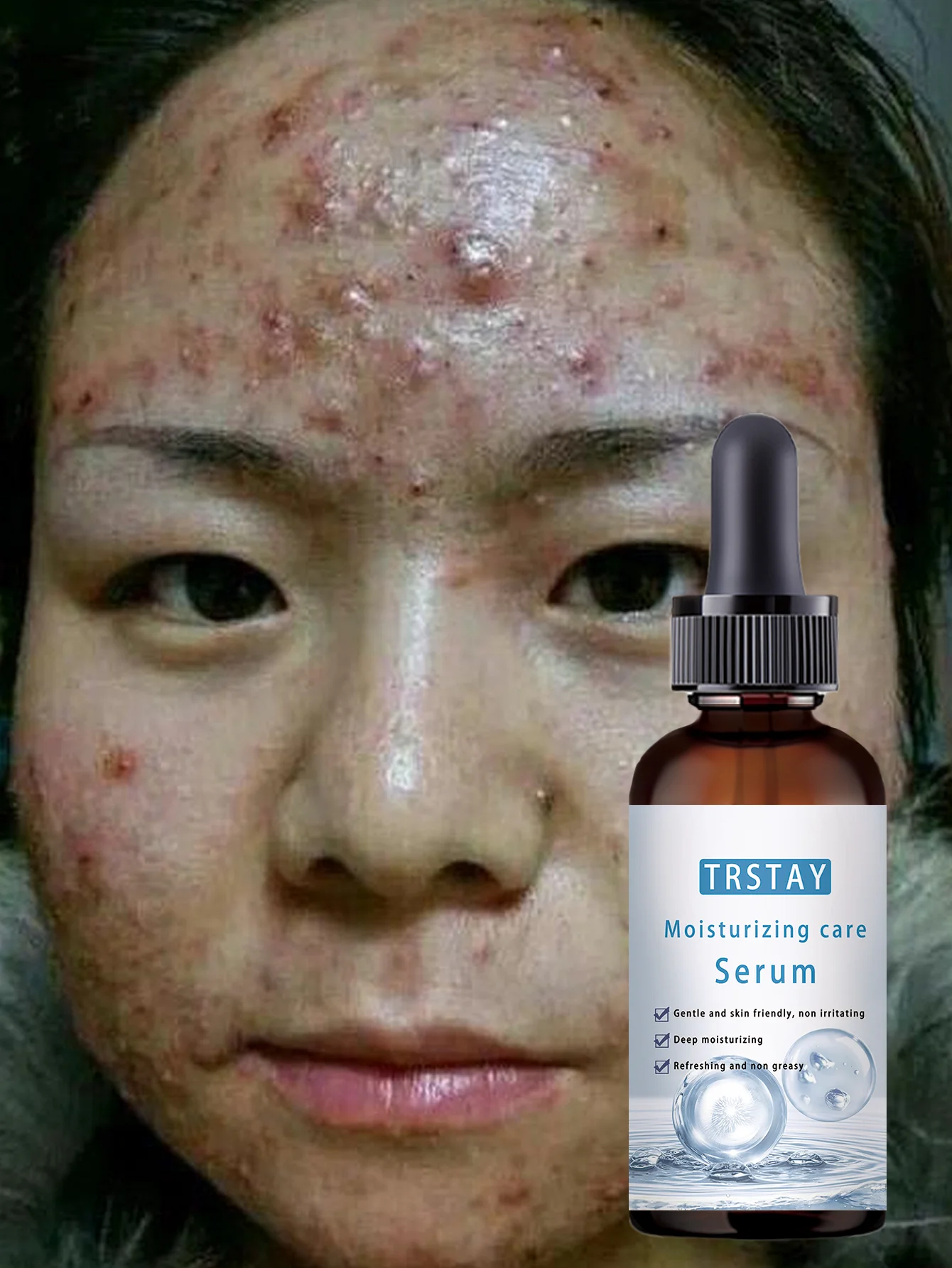 All Skin Types Brightening Serum Hydrates and Fights Acne Boosts Skin Elasticity Reduces Dryness and Looseness for Youthful Glow - Image 6