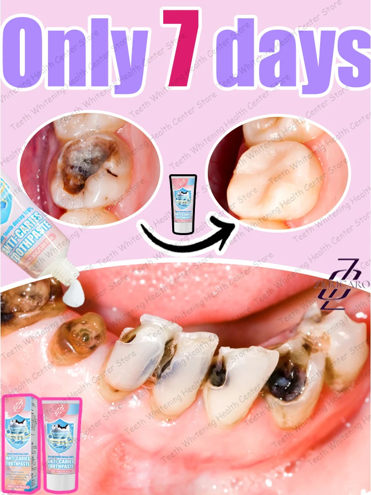 

2025 Latest Cavity Repair and Teeth Cleaning