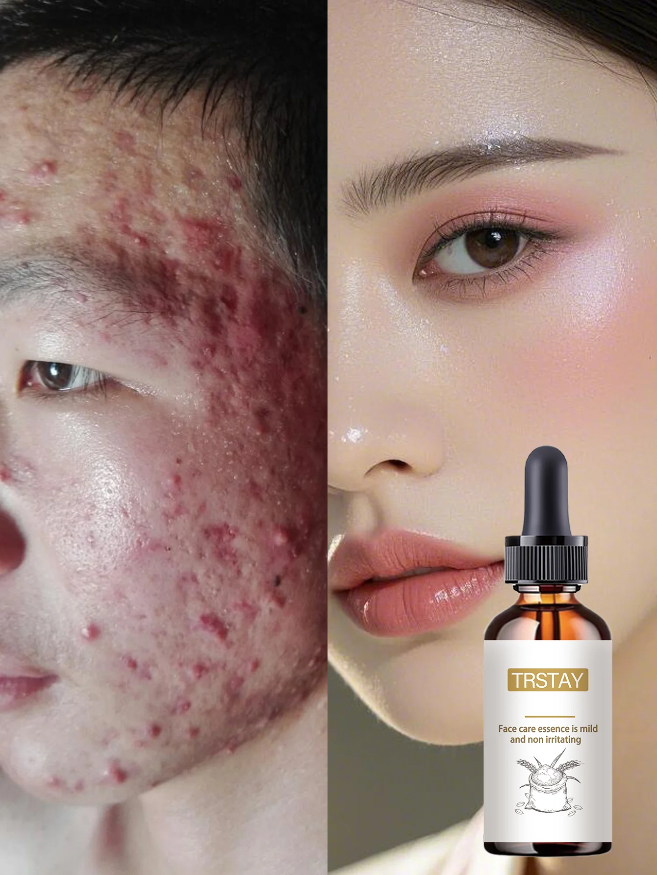Moisturizing Spot Lightening And Skin Brightening Essence With Hydrating Formula To Even Skin Tone And Enhance Glow For Radiant - Image 2