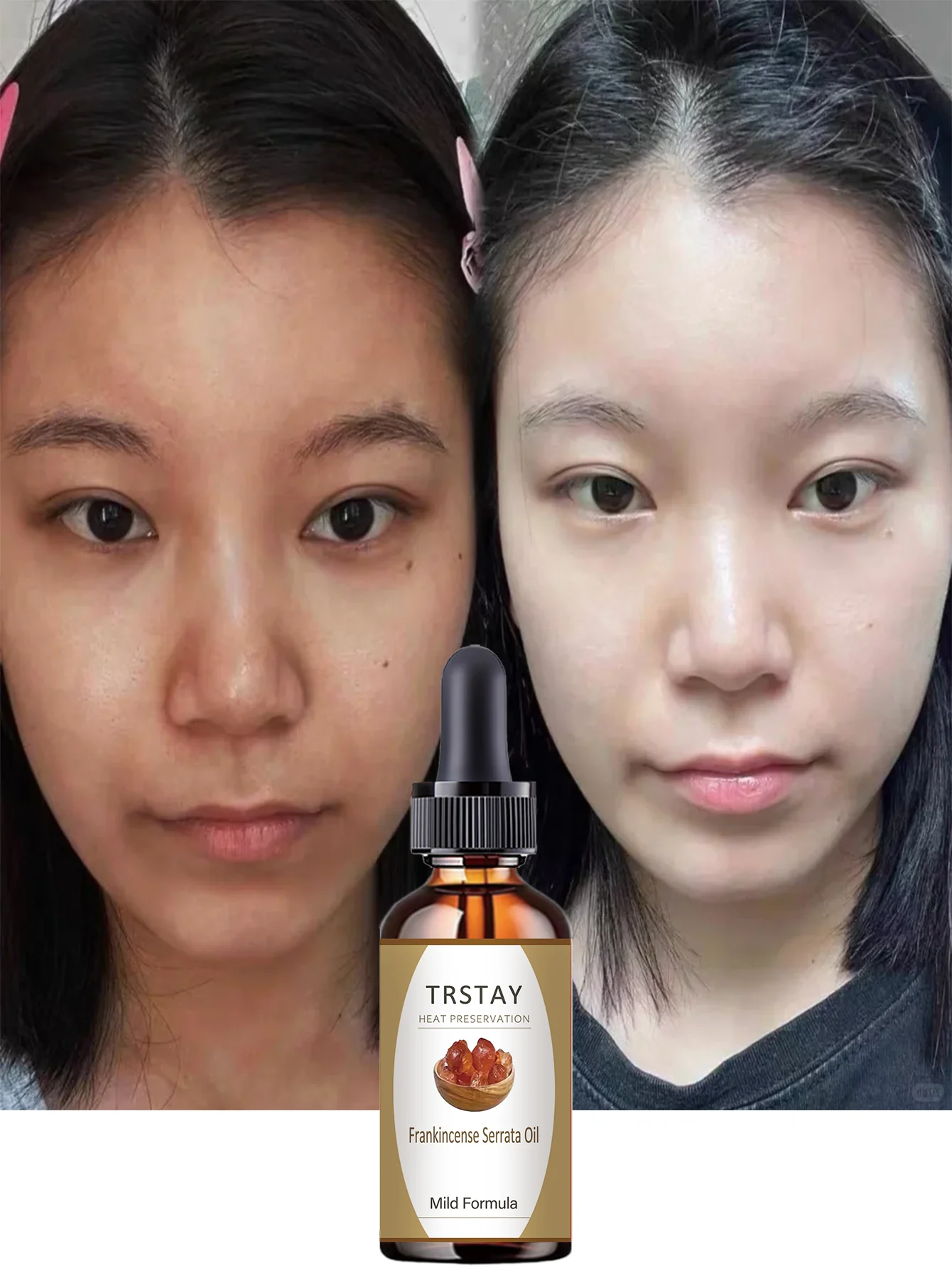 Hydrating Fast Penetrating Facial Oil with Natural Extracts for Deep Moisture and Instant Brightening Suitable for All Skin Type - Image 2