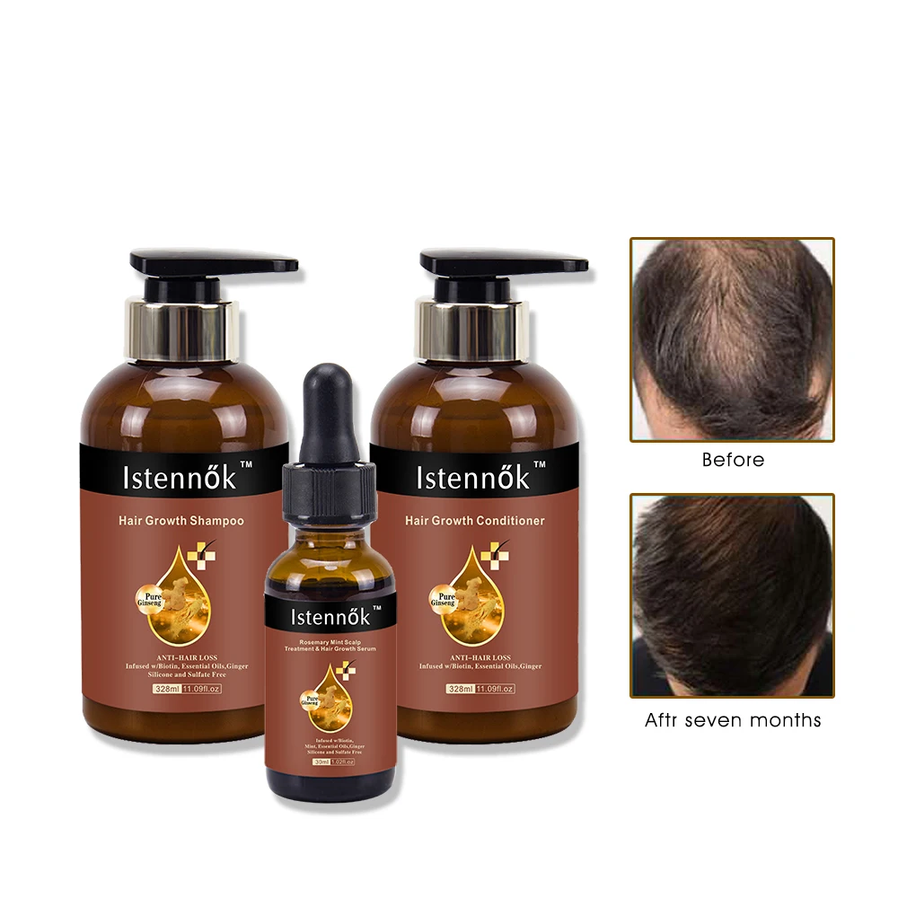 2023 Professional Hair Growth Products Shampoo And Conditioner Serum For Women Men Ginger Hair Regrowth Set Anti Hair Loss