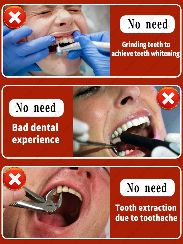 Casos Restauração e Reparação Dente, Anti Cavidade, Anti Restauração Dente