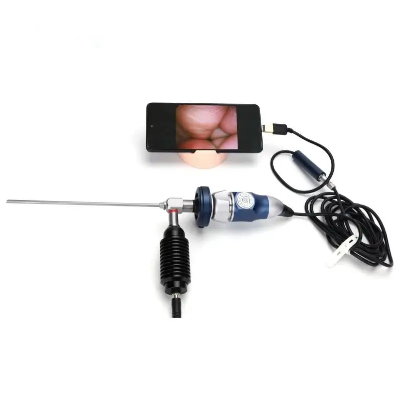 1080P Medical Endoscope Camera for ENT Surgery & Inspection - HDMI & USB Video Output for Clinic & Hospital Use