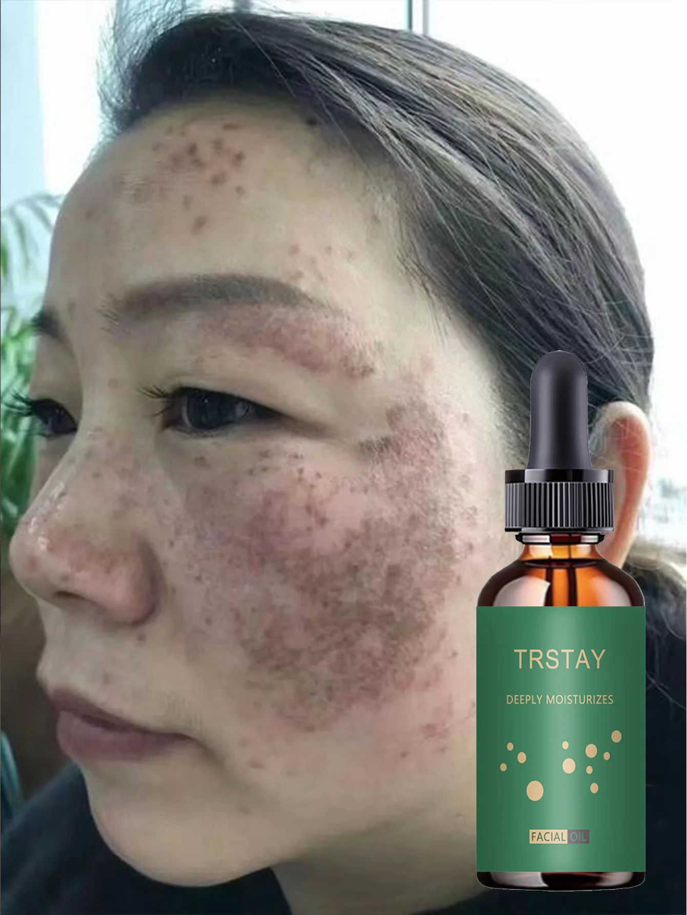 Facial Moisturizing Serum - Gentle and Non-Irritating, With Plant Extracts, Hydrating and Moisturizing, Suitable for All Skin Ty - Image 5