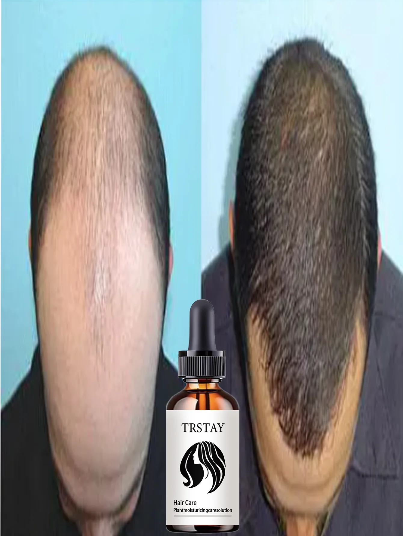 Moisturizing Advanced Hair Smoothing Treatment For Strong Glossy Hair Gradually Improves Hair Health With Multiple Specs To Nour - Image 6