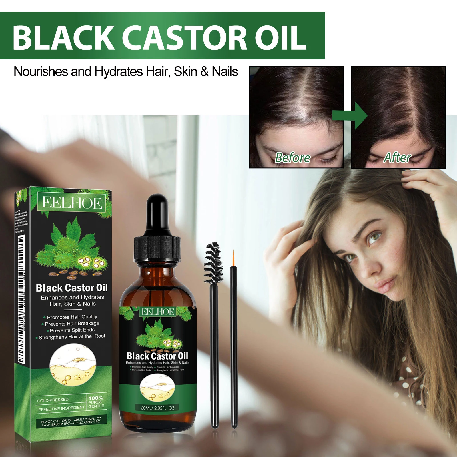 Eelhoe Castor Oil cabelo condicionador, evitar a perda de cabelo e melhorar os problemas do folículo capilar