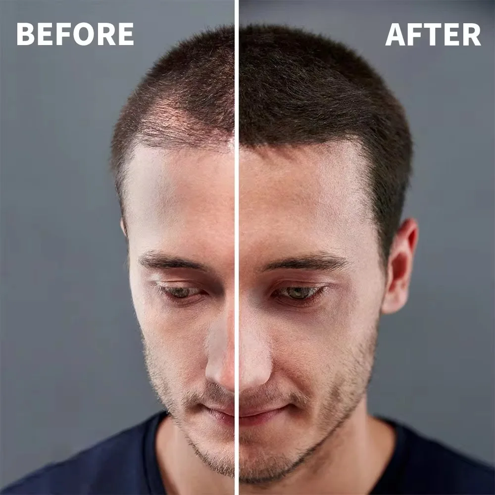 ブニーヘアファイバーパウダーは、薄毛をカバーし、髪のボリュームを増やします。 耐水性。