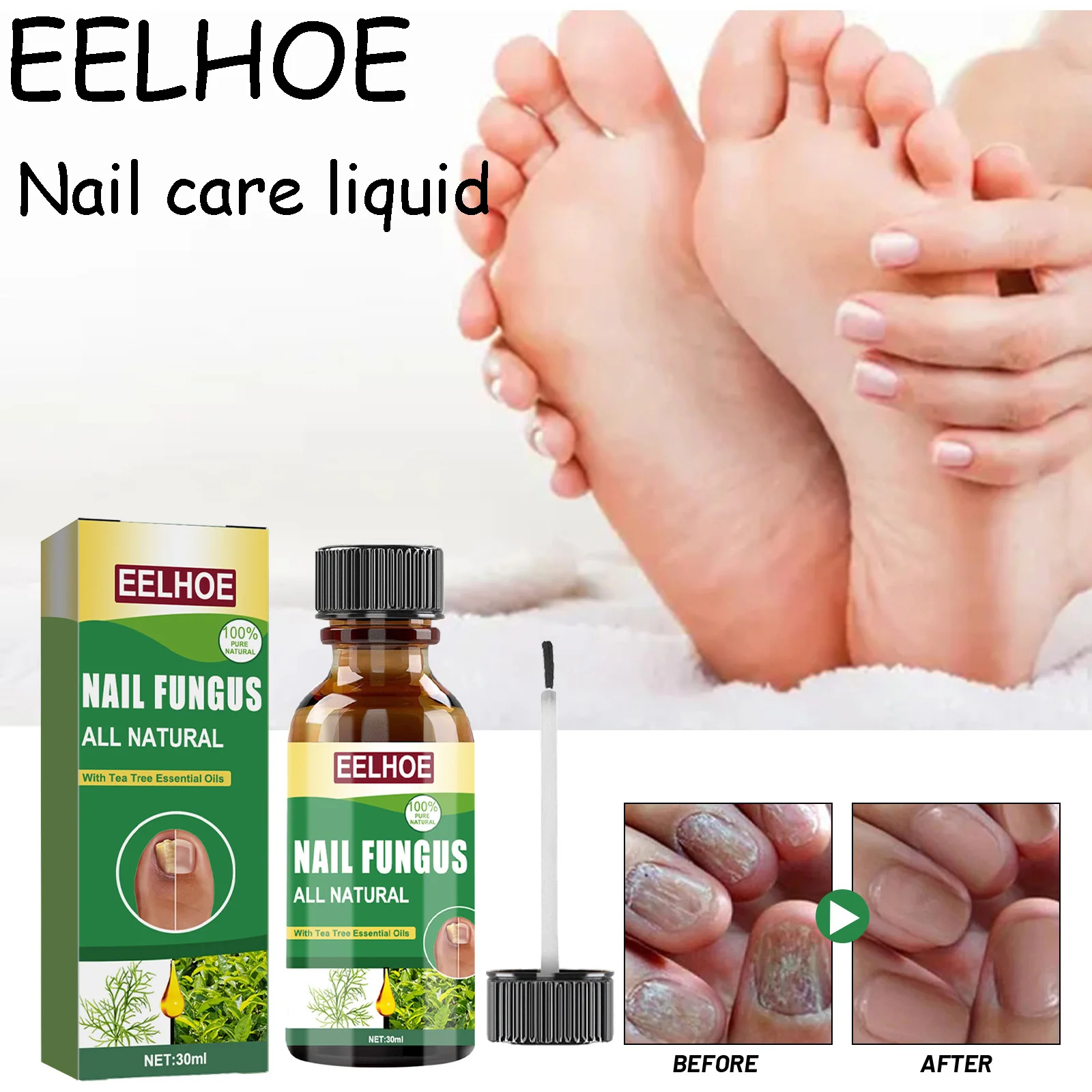 EELHOE شجرة الشاي مسمار إصلاح السائل المغذي اليد القدم مسمار تعزيز الإغاثة الانزعاج مسمار Funus علاج زيت العناية بالأظافر