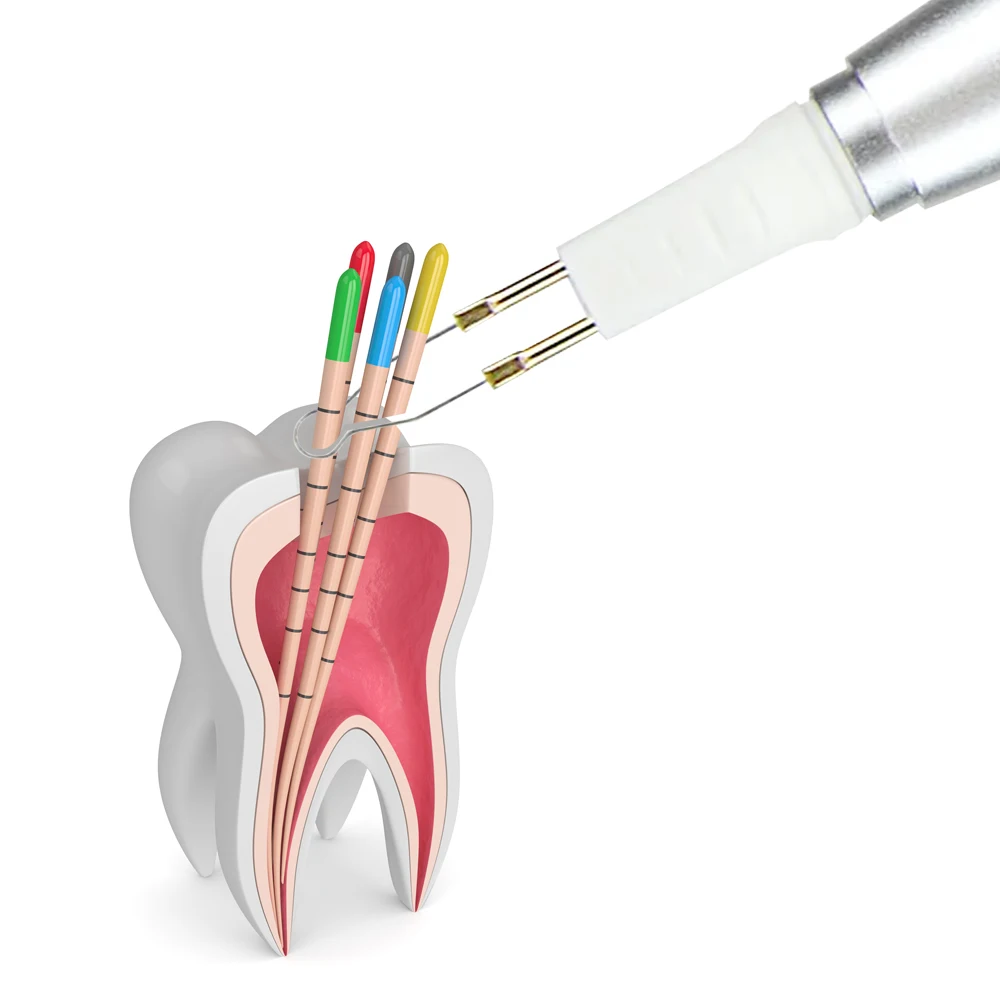 Exp-puntas de corte de Guta calentada Dental, cortador de punto de calentamiento, goma de dientes, 4 puntas, modelo blanco, 4 unids/lote por paquete