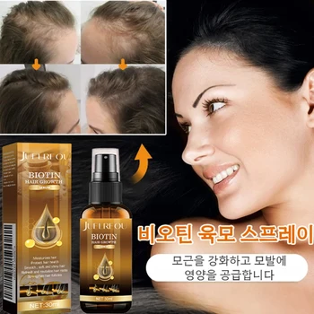 모발 성장 에센셜 오일 머리발모제에센스 탈모 방지 및 발모 미스트 헤어 탈모 미스트 탈모 트리트먼트/  업그레이드 모델/ 무효전액환불 