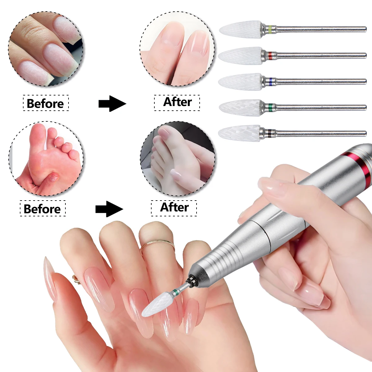 5個入りセラミックネイルドリルビットセット、プロ仕様のコーン型セラミックビット、シェーピング、研磨、アクリルジェルネイルの除去に