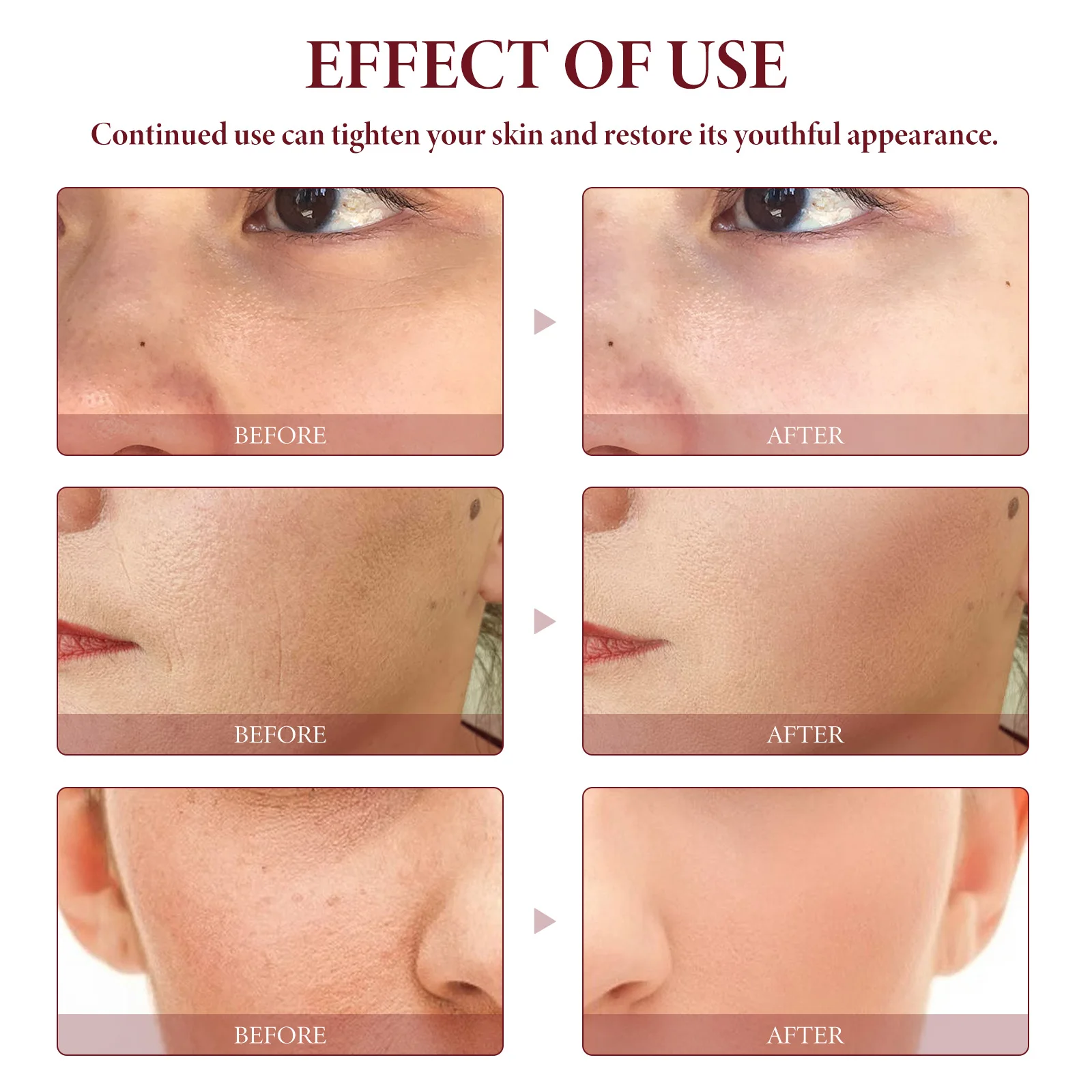 Oceaura-suero Facial de aceite de rosa mosqueta, se desvanece, líneas finas, hidratante, elimina las arrugas, mejora la elasticidad de la piel, suero Facial reafirmante