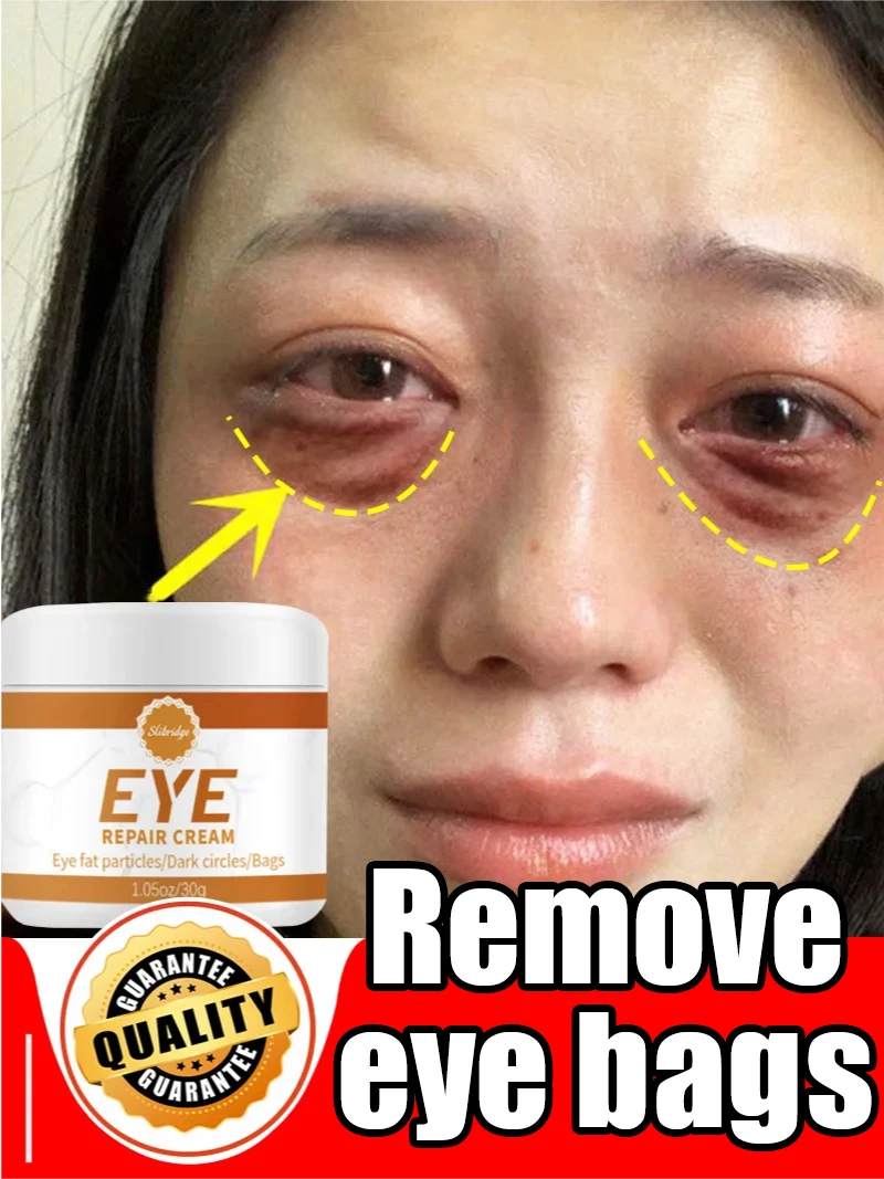 Instant Eye Bag Removal Cream Collagen Removal Wrinkles Firming Skin Fade Fine Lines Brighten Dark Circle Anti Puffiness Korean